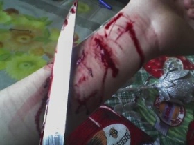 Порезанные вены. Фото: img1.liveinternet.ru Порезанные вены. Фото: img1.liveinternet.ru