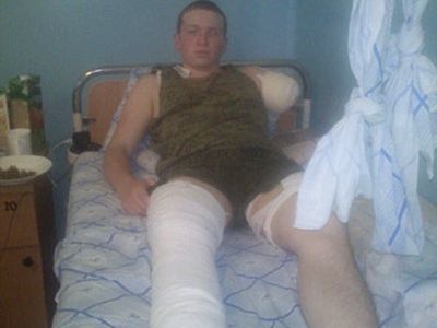 Изувеченный солдат. Фото: предоставлено Каспарову.Ru родными Изувеченный солдат. Фото: предоставлено Каспарову.Ru родными