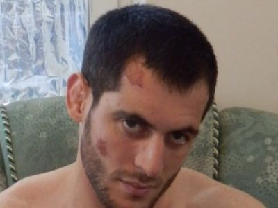 После пыток в полиции. Фото: Комитет против пыток После пыток в полиции. Фото: Комитет против пыток