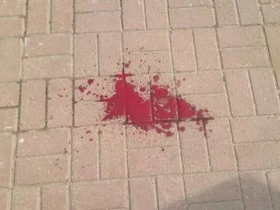 Следы избиения наблюдателей на выборах в Железнодорожном, 26.4.15. Источник - http://www.golosinfo.org/ru/articles/1651?PageSpeed=noscript Следы избиения наблюдателей на выборах в Железнодорожном, 26.4.15. Источник - http://www.golosinfo.org/ru/articles/1651?PageSpeed=noscript