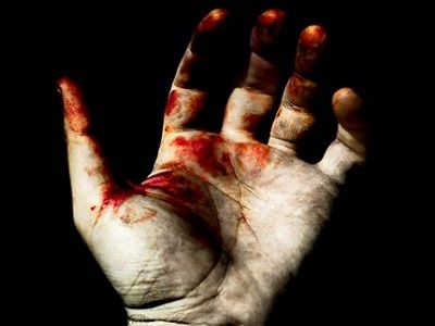 Окровавленная рука. Фото: cdn.minval.az Окровавленная рука. Фото: cdn.minval.az