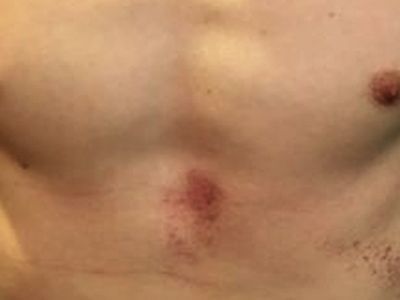 Следы избиения в колонии. Фото: stop-torture.info Следы избиения в колонии. Фото: stop-torture.info