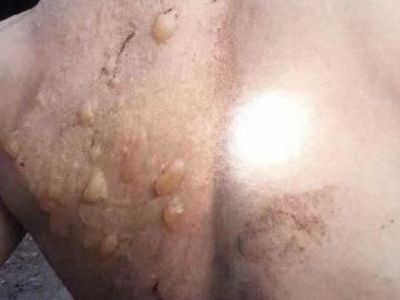 После пыток в полиции. Фото: Радио Свобода После пыток в полиции. Фото: Радио Свобода