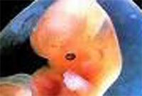 � �������������� ������ ������ �������� �� �������� ���������-�����