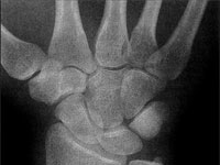 Ученые изобрели безвредную альтернативу рентгену