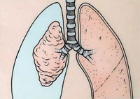 ������������ ��������� � ��������� ���� � ������� ���� ������