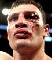 ��������� ��������: �������: ��������� �������