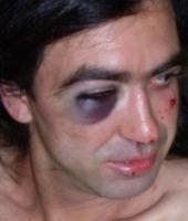 �� ������������� ������ �������� ������� ����� ������ ����� �������