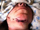 � �������� ��-�� ������ ����� ��������� � ����� ��������� ������������